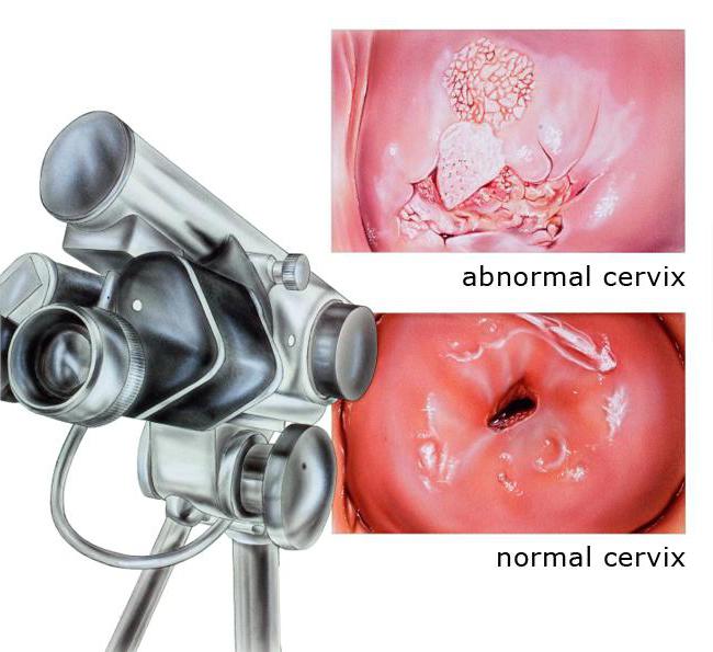 Porno rasmlar sanati