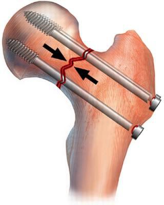 Писка және жамбас