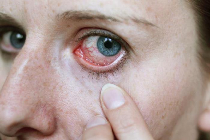 tratamentul ochilor cu vierme rotunde)