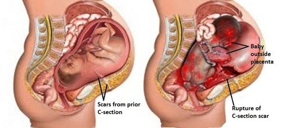 Объектілермен жыныстық қатынас туралы бейне