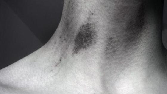 Біліксіздермен порно