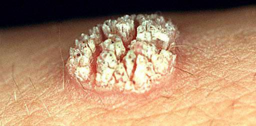 Ер адам траншейдің үлкен мүшесін сорып алады