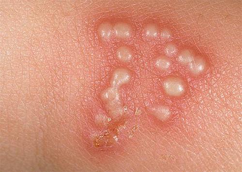 Онлайн тарақ порно