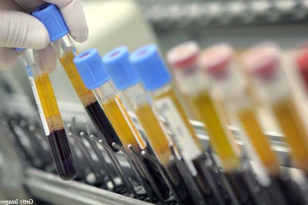 Jinsiy ogil bolalar Bilyard stolida sariq porno