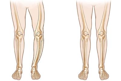 Қисық қыздар