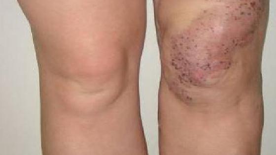 Порно фото галереялар спермы письки