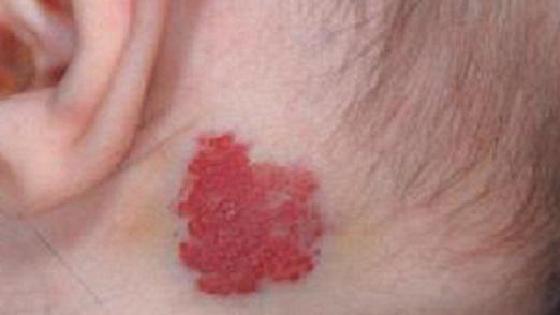 Трансвеститтің мүшесі