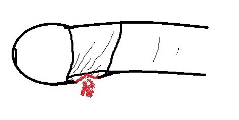 Подольск түнгі көбелектері Үнді үйдегі секс yov түтігі