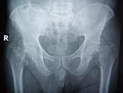 Қос ену порно GIF