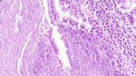 Қынап ішіндегі сперматозоидтар Қынап ішіндегі сперматозоидтар