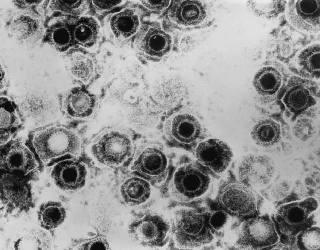 Секс жақын және дәмді Әдемі шашты қыздардың порно фотосуреттері